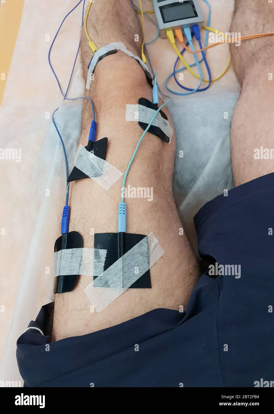 Elektrostimulation des Quadrizeps als Physiotherapie Stockfoto