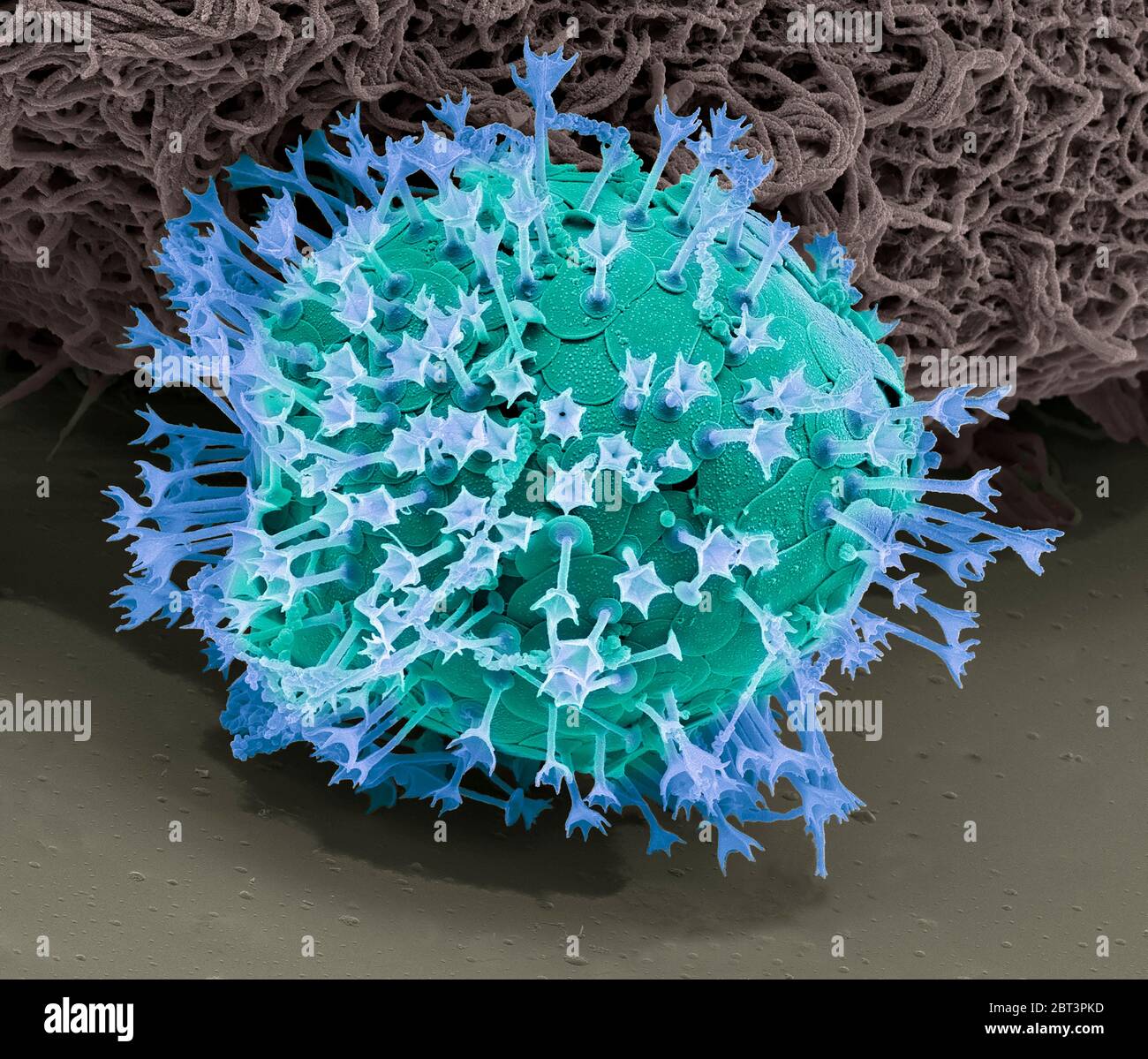 Acanthocystis. Farbige Rasterelektronenmikrographie (SEM) eines Zentroheliden Heliozoans mit Tangentialplattenskalen und radialen Dornen. Diese Gattung Acanthocystis enthält einzellige, frei schwimmende planktonische oder benthonische Lebewesen, die im Süßwasser häufig vorkommen, aber auch seltener in marinen Lebensräumen vorkommen. Die evolutionäre Position der Zentroheliden ist nicht klar. Vergrößerung: X 2500, wenn gedruckt 10 Zentimeter breit. Stockfoto