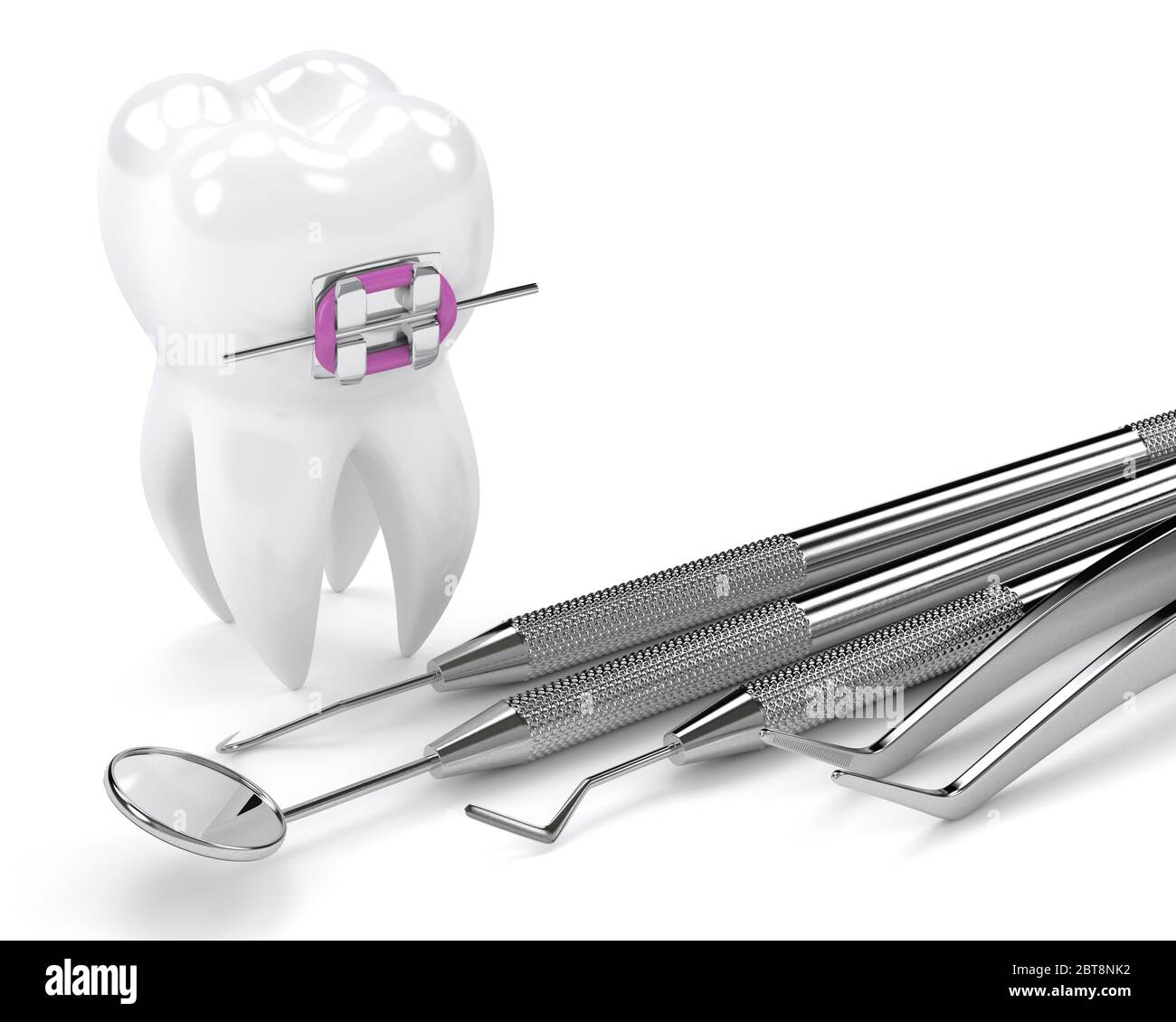3d-Rendering von Zahn mit Zahnspangen und zahndiagnostischen Instrumenten auf weißem Hintergrund Stockfoto