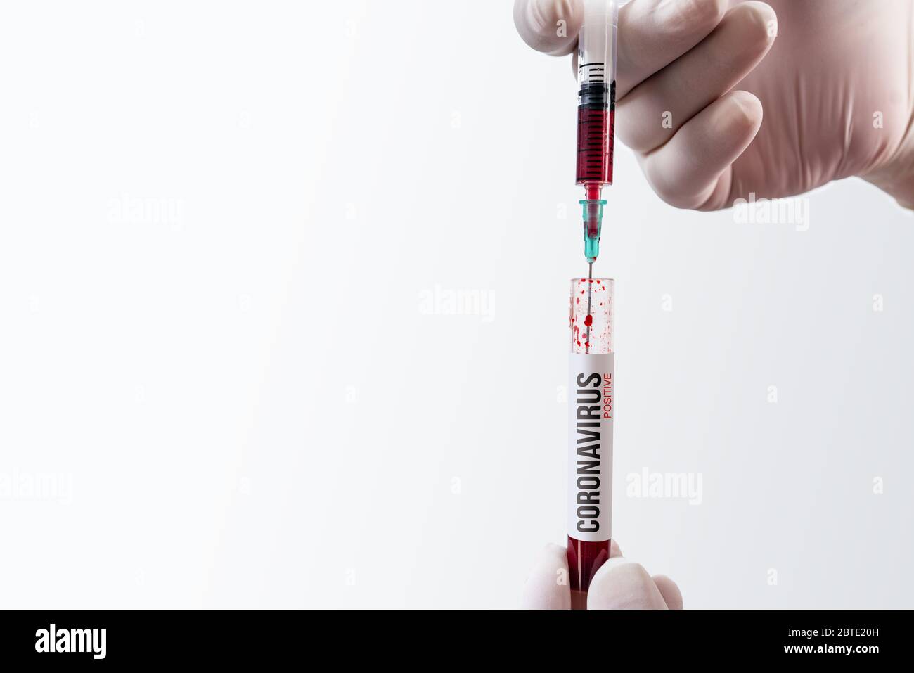 Blutprobe in einem Kolben zur Analyse des Corona-Virus und zur Herstellung eines Impfstoffs. Corona-Virus bricht aus Stockfoto