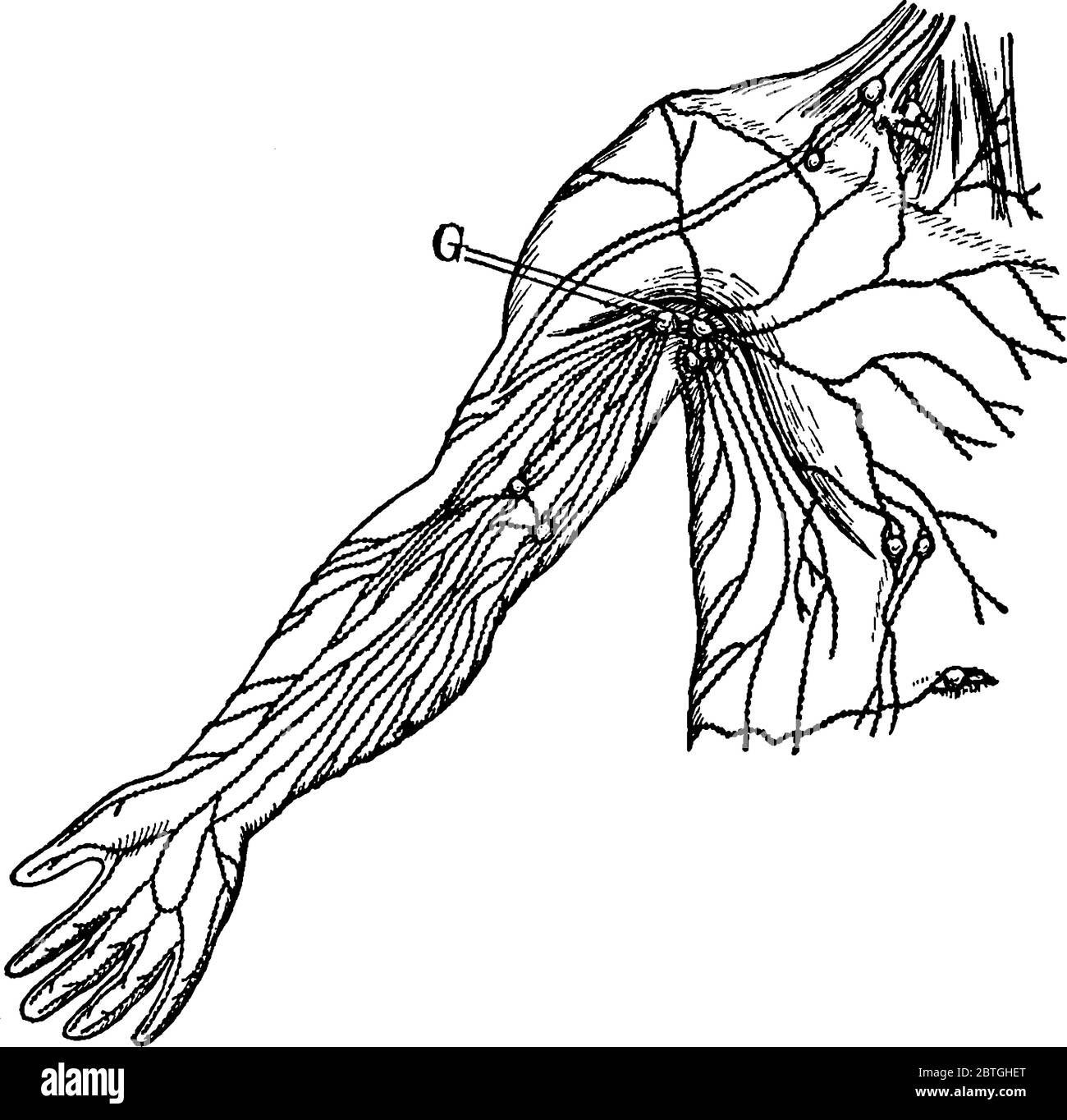 Eine typische Darstellung der oberflächlichen Lymphatika und Drüsen, deren Teile als G bezeichnet sind, die Axillardrüsen darstellen, Vintage-Linienzeichnung Stock Vektor