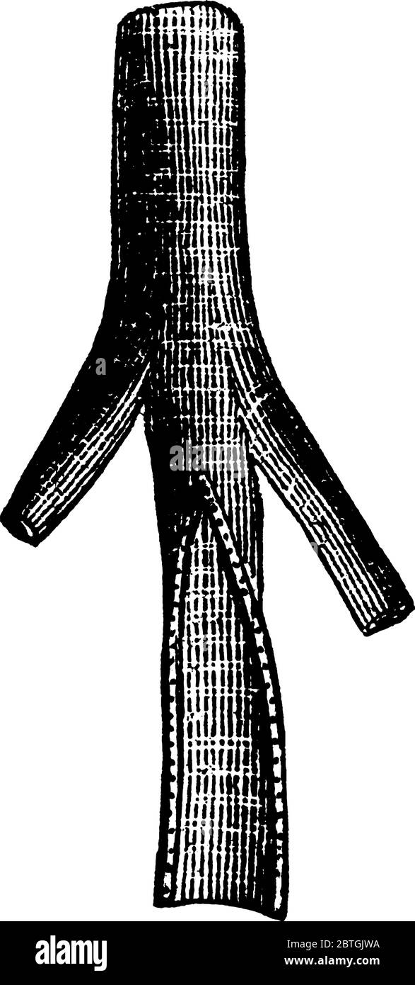 Eine typische Darstellung des Teils einer Arterie, eines Blutgefäßes, das Blut vom Herzen in alle Teile des Körpers abnimmt, Vintage-Strichzeichnung Stock Vektor