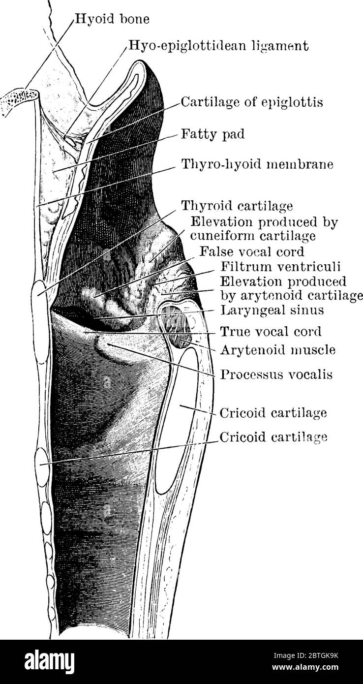 Mesialschnitt durch den Kehlkopf, zeigt die äußere Wand der rechten Hälfte. Die Figur ist mit ihren jeweiligen Teilen, Vintage-Linienzeichnung oder engr Stock Vektor