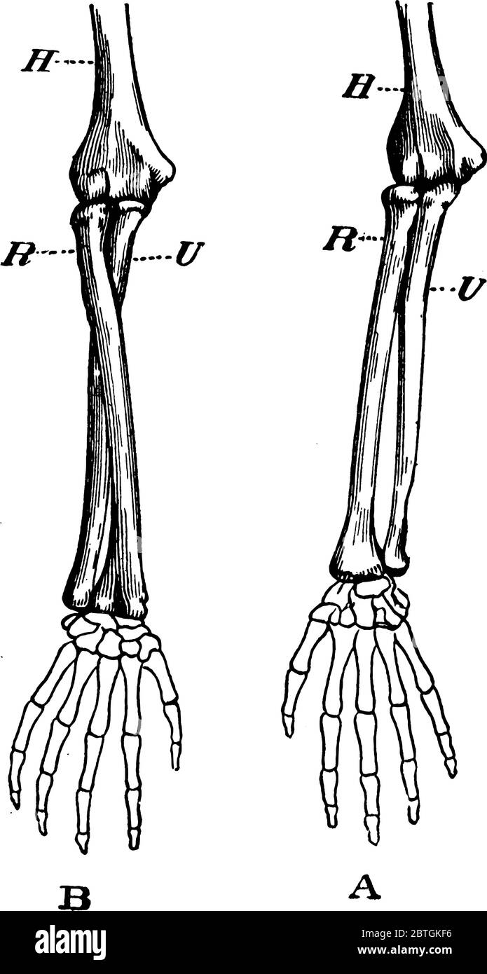 Eine typische Darstellung der menschlichen Knochen des Arms. Etiketten: A, Arm in Supination; B, Arm in Pronation. H, Humerus; R, Radius und U, Ulna, Jahrgang Stock Vektor
