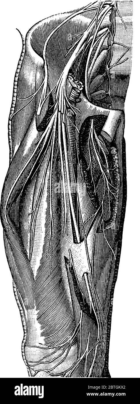 Ein großer Nerv, Krural, und seine Äste auf der Vorderseite des menschlichen Oberschenkels. Hier ist die Arteria femoralis mit ihrem Schnittende, Vintage-Linienzeichnung oder e dargestellt Stock Vektor