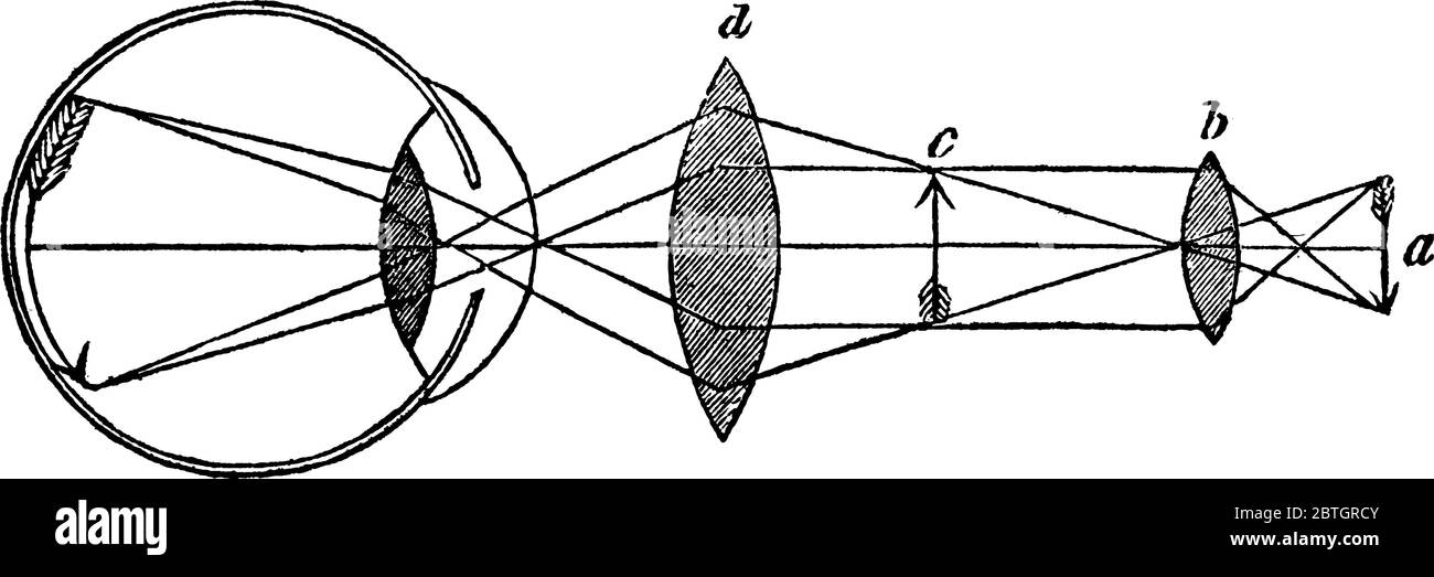 Eine typische Darstellung eines Mischmikroskops mit zwei konvexen Linsen, von denen eine das Bild innerhalb der Röhre des Instrumentand bildet Stock Vektor