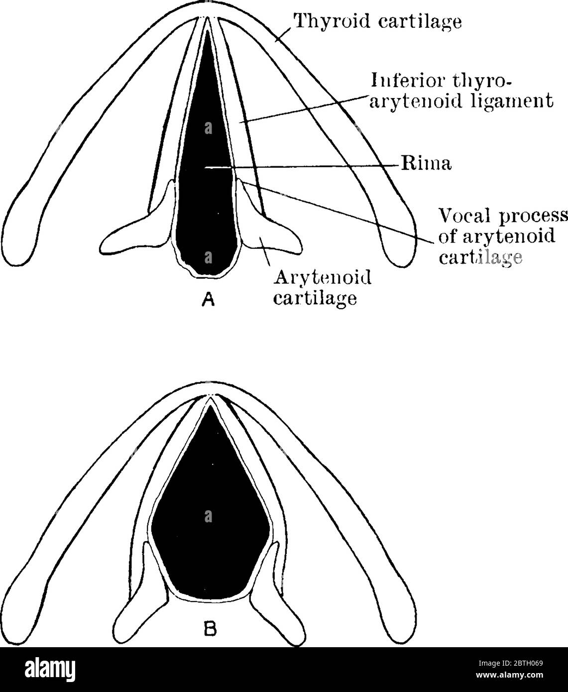 RIMA-Glottiden. Auf zwei Arten, während der gewöhnlichen leichten Atmung und wenn weit geöffnet, Vintage-Linie Zeichnung oder Gravur Illustration. Stock Vektor