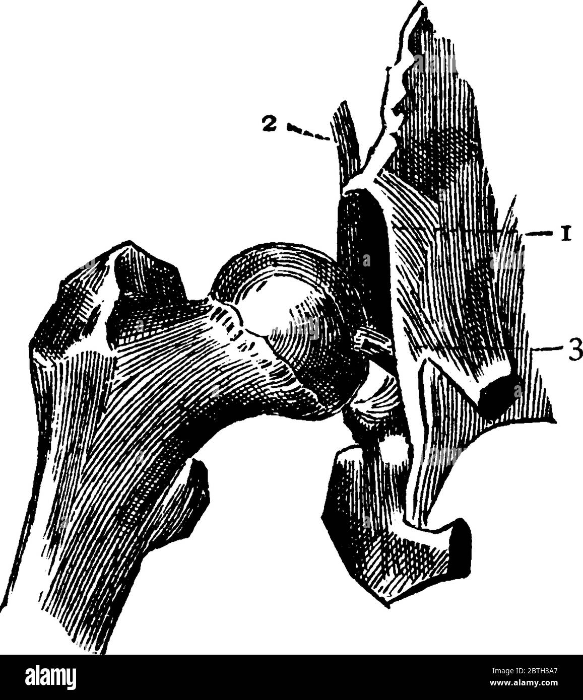 Hüftgelenk mit abgeschnittendem Kapselband, mit Markierungen, '1, 2 und 3', die den Rand der Muffe, den Teil des Kapselbandes und das runde Band darstellen Stock Vektor