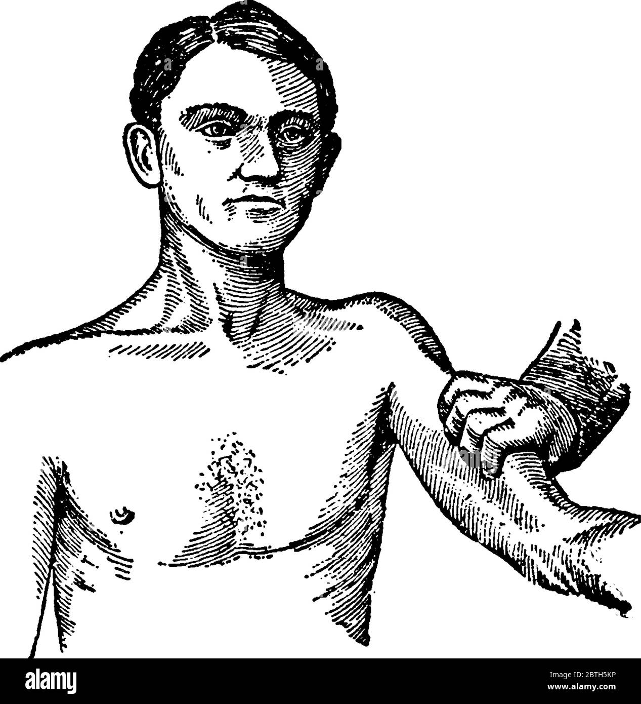 Stellt die Verzweigungs-Kompression dar, bei Blutungen aus irgendeinem Teil des Arms sollte die Verzweigungs-Arterie nach außen gegen den Knochen direkt hinter t gedrückt werden Stock Vektor