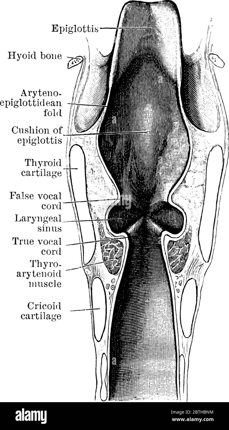 Koronale Sektion durch den Kehlkopf und seine drei Kompartimente. Die Figur ist mit ihren jeweiligen Teilen, Vintage-Strichzeichnung oder Gravur illustra beschriftet Stock Vektor