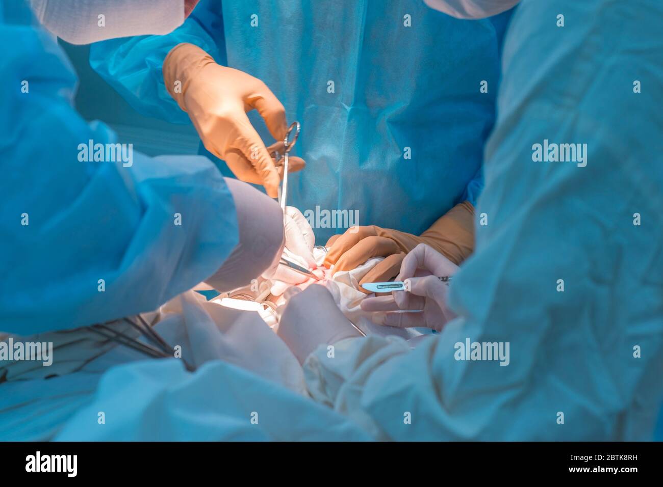Nahaufnahme, die Hände von Kinderchirurgen und ein Assistent, der einen kleinen Patienten mit einer Hinter-Ohr-Lymphadenitis operiert. In einem sterilen Operationssaal. R Stockfoto