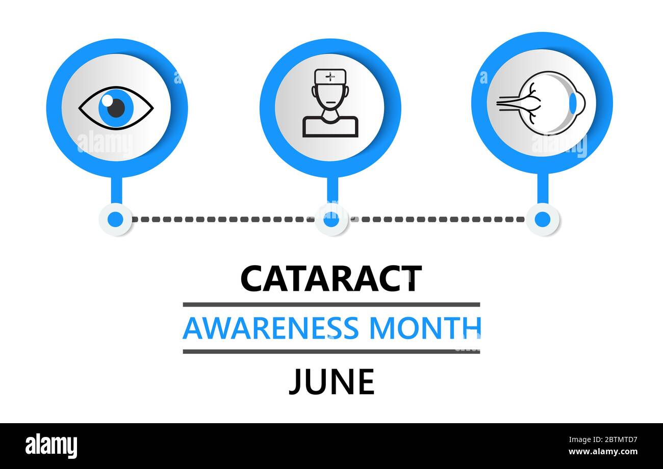 Der Monat der Katarakt-Sensibilisierung wird im Juni gefeiert. Glaukomerkrankungen und Nephropathie Probleme. Abbildung des ophthalmologischen Konzepts. Augenkontrolle mit Witz Stock Vektor