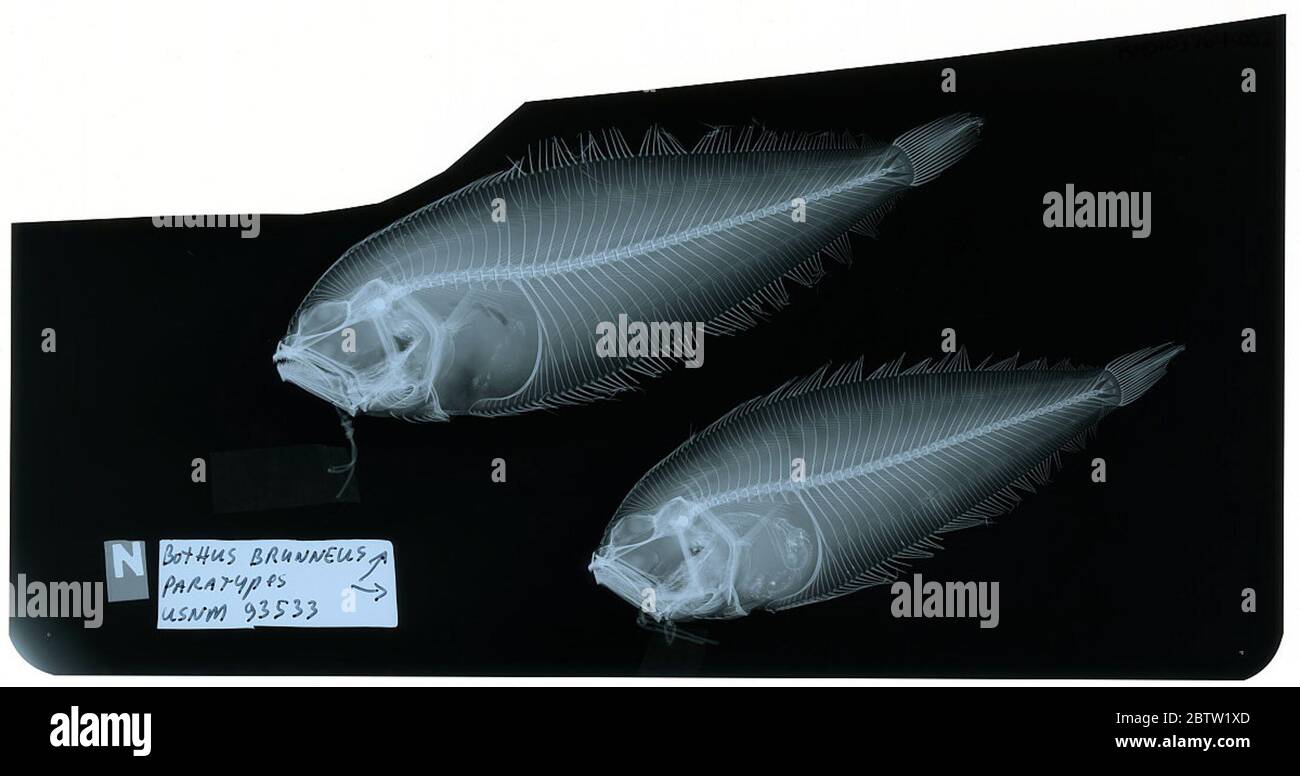 Bothus brunneus. Die Röntgenaufnahme ist von einem Paratyp; die Smithsonian NMNH Division of Fishes verwendet die Konvention, den ursprünglichen Artnamen für Typexemplare beizubehalten, die zum Zeitpunkt der Beschreibung benannt wurden. Der derzeit akzeptierte Name für diese Art ist Arnoglossus brunneus.29 Okt 2018D 52732 Stockfoto