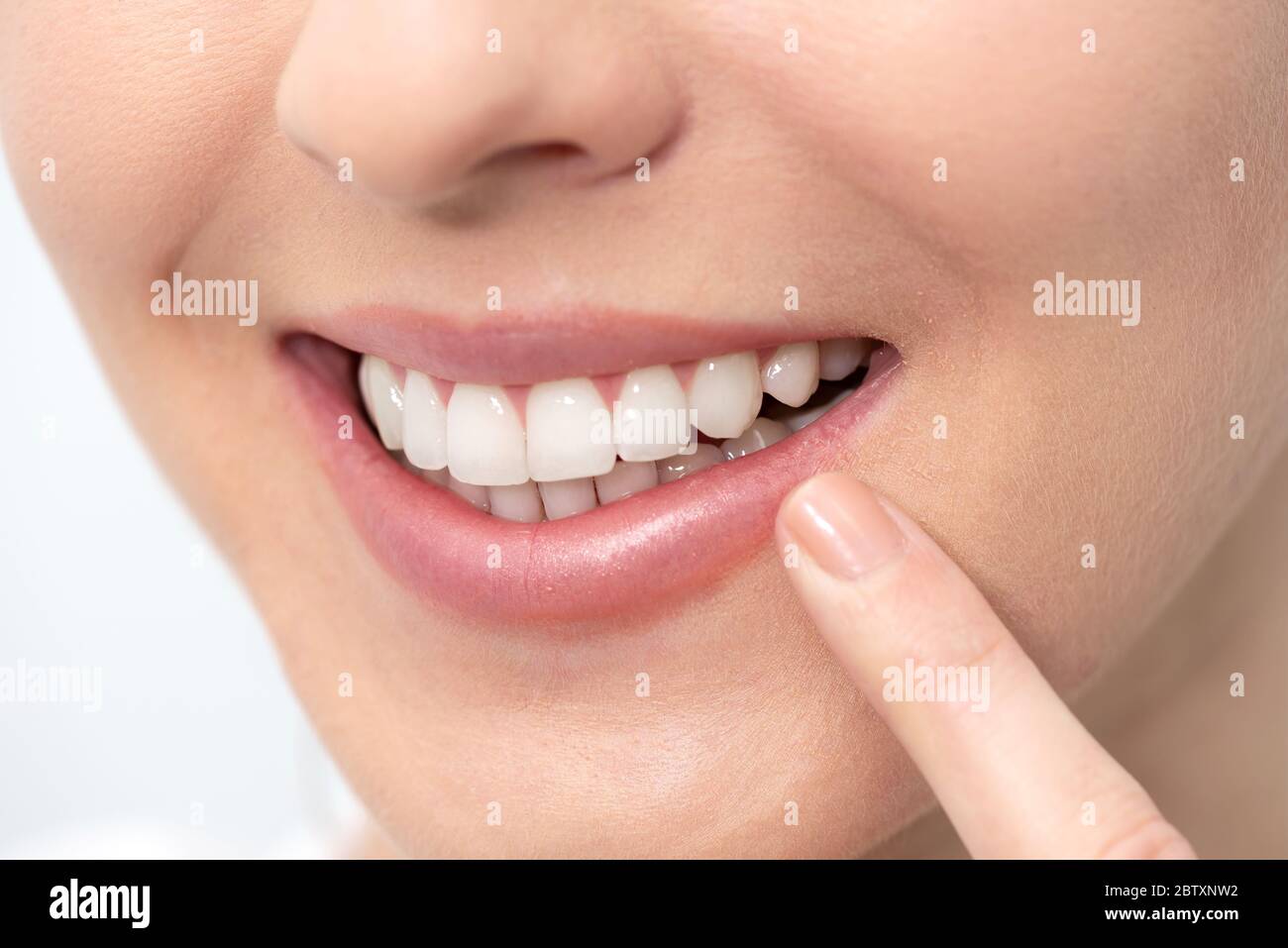 Frau zeigt perfektes Lächeln. Zahnaufhellung, Zahnpflege-Konzept Stockfoto