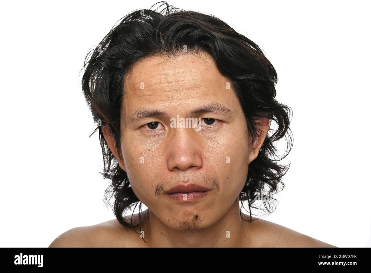 Gesichtsnah oben: Asiatische Männer im Alter von 35-40 Jahren mit Falten Krähen Füße, Mangel an Hautpflege Stockfoto