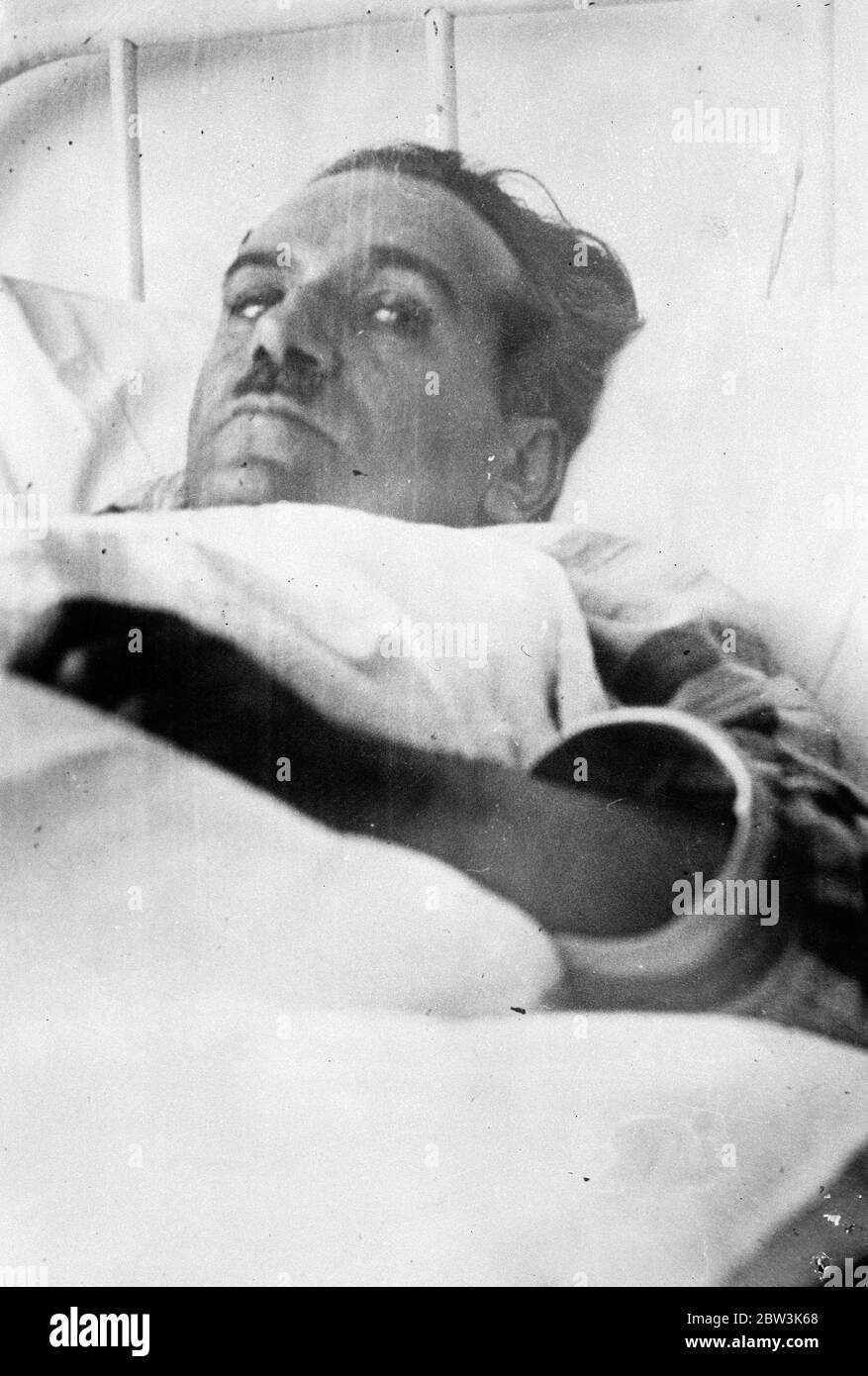 Erstes Bild des neuen griechischen Aufstands. Stellvertretender Schuss in heftigen Kämpfen . M Penayictecos , der republikanische Abgeordnete , im Krankenhaus, nachdem er in den Kämpfen in Athen erschossen worden . 12. September 1935 Stockfoto