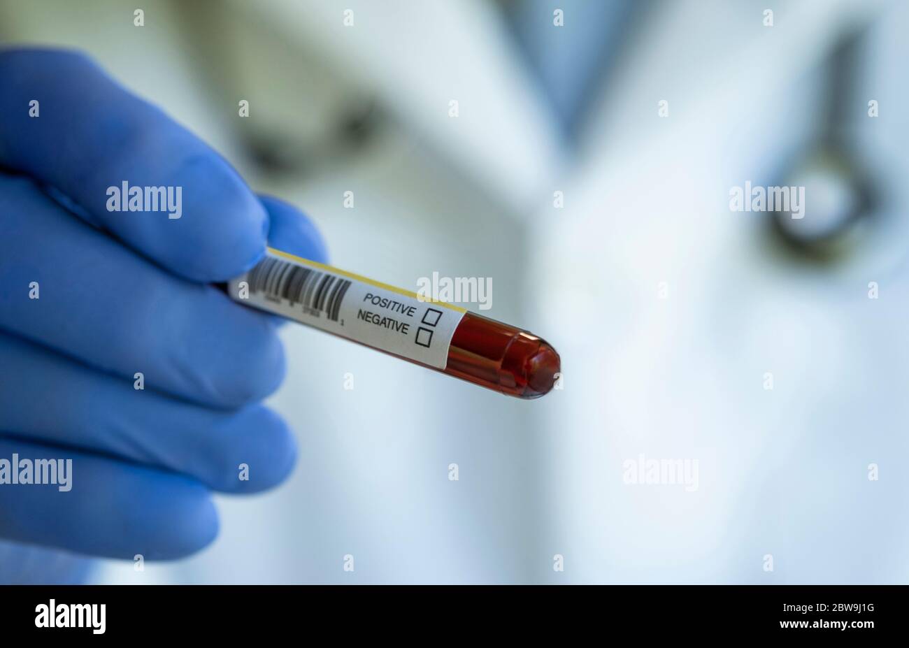 Nahaufnahme der Hand des Arztes, die die Blutprobe hält Stockfoto