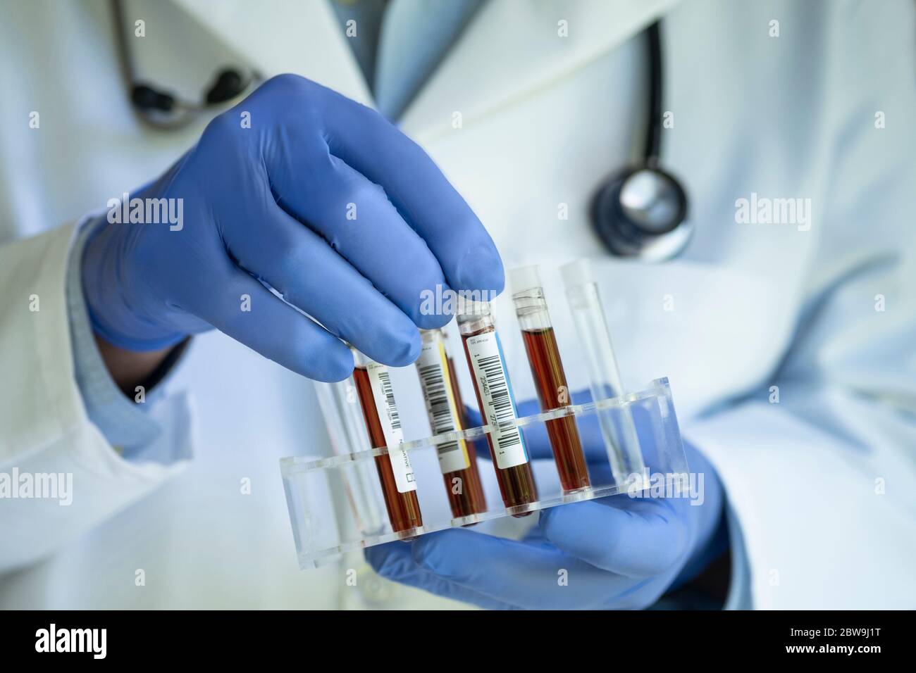 Nahaufnahme der Ärzte Hände halten Reagenzglasgestell mit Blut Beispiele Stockfoto