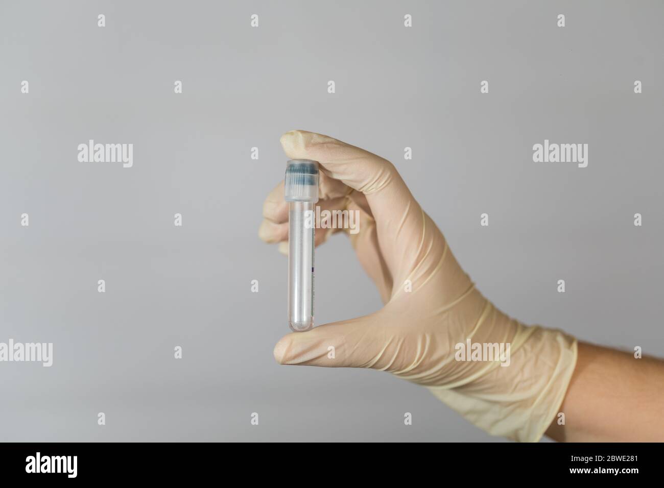 Leeres Reagenzglas für die Biomaterialanalyse in den Händen einer Pflegekraft. Klinische Virenanalyse mit Vorsichtsmaßnahmen. Stockfoto