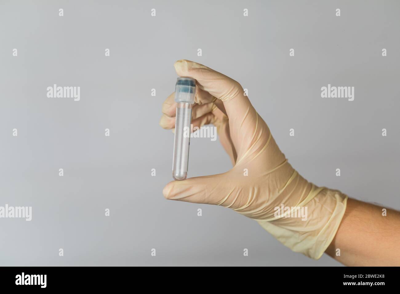 Leeres Reagenzglas für die Biomaterialanalyse in den Händen einer Pflegekraft. Klinische Virenanalyse mit Vorsichtsmaßnahmen. Stockfoto