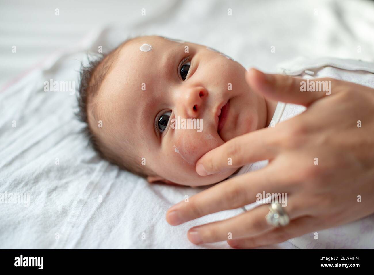 Mutter Anwendung antiallergische Creme bei Baby Gesicht mit Hautausschlag und Allergie Stockfoto