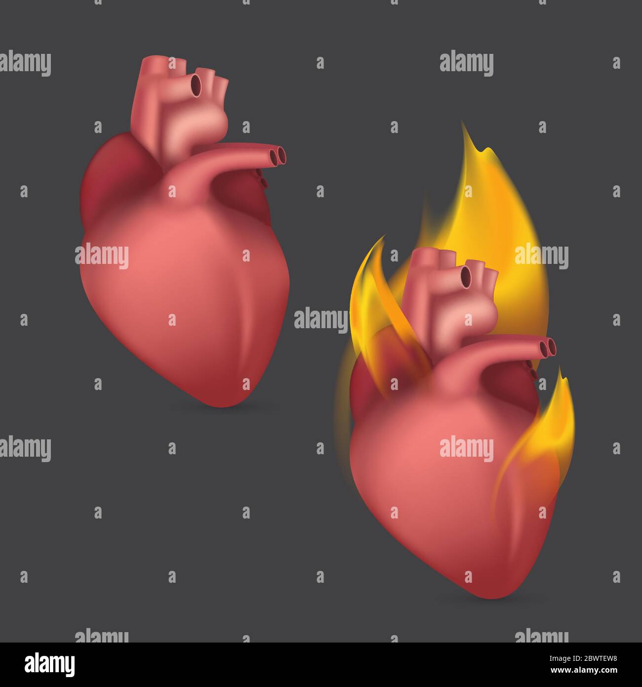 Brennendes anatomisches Herz. Realistisches menschliches Organ des inneren Blutkreislaufsystems in der Flamme. Vektorgrafik Stock Vektor