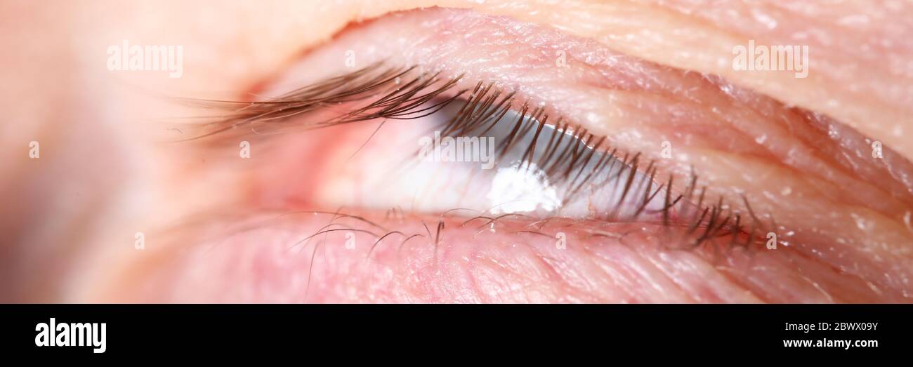 Männliche Wimpern extrem nah-up mit Augen gerollt Stockfoto