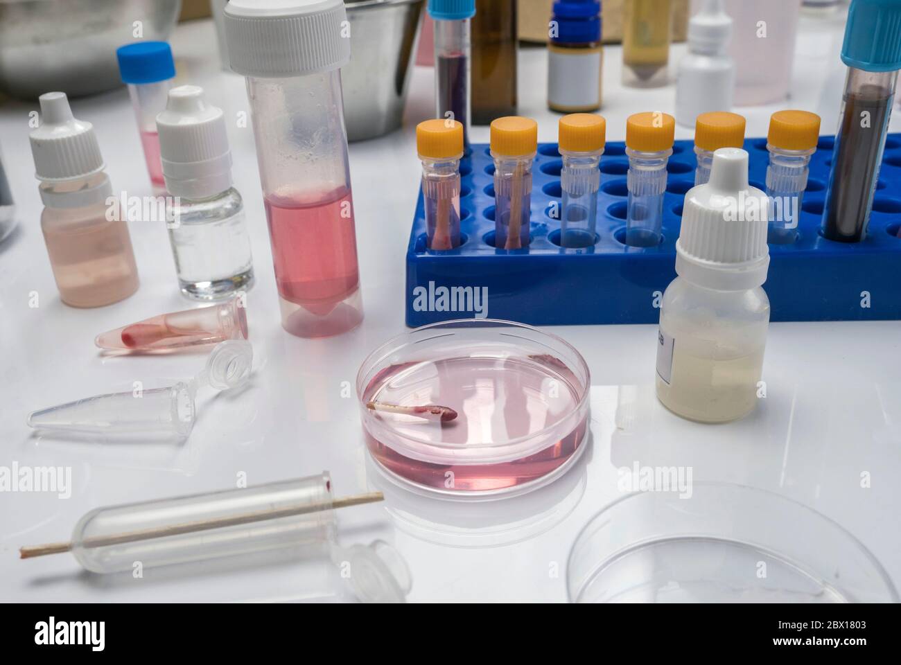 Hämatologische Analyse mit forensischem Testkit in einem Mord in einem Kriminallabor, konzeptionelles Bild Stockfoto