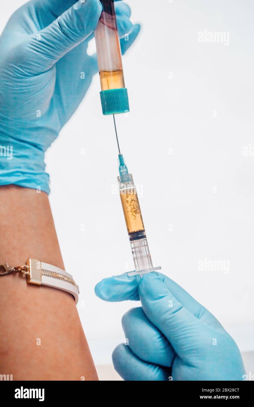 Vertikales Bildformat - Plasma-Lifting - der Arzt sammelt Plasma aus dem Röhrchen in die Spritze Stockfoto