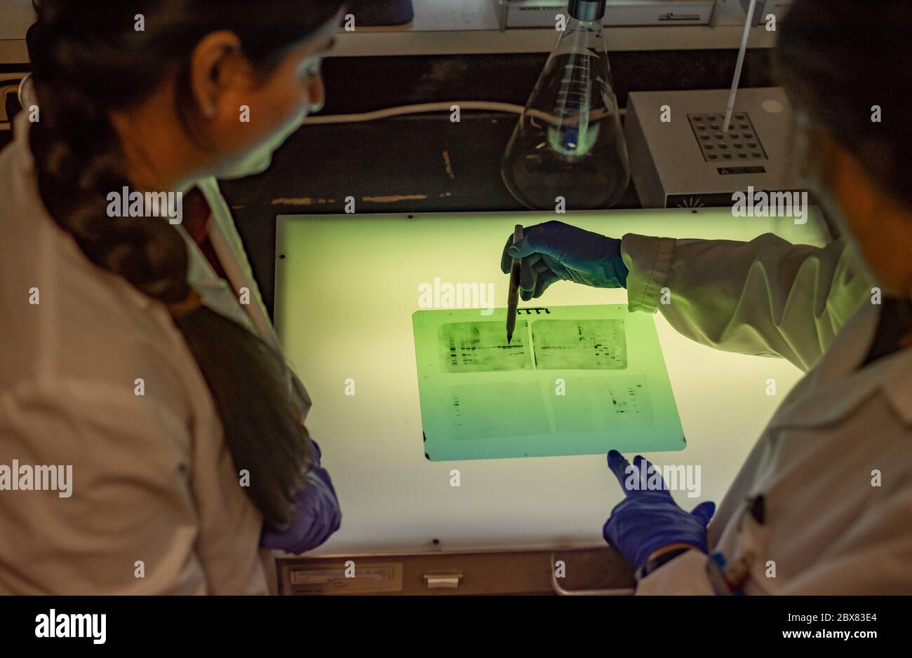 Biomedizinische Forscherin untersucht einen Western Blot Film auf Proteintrennung Stockfoto