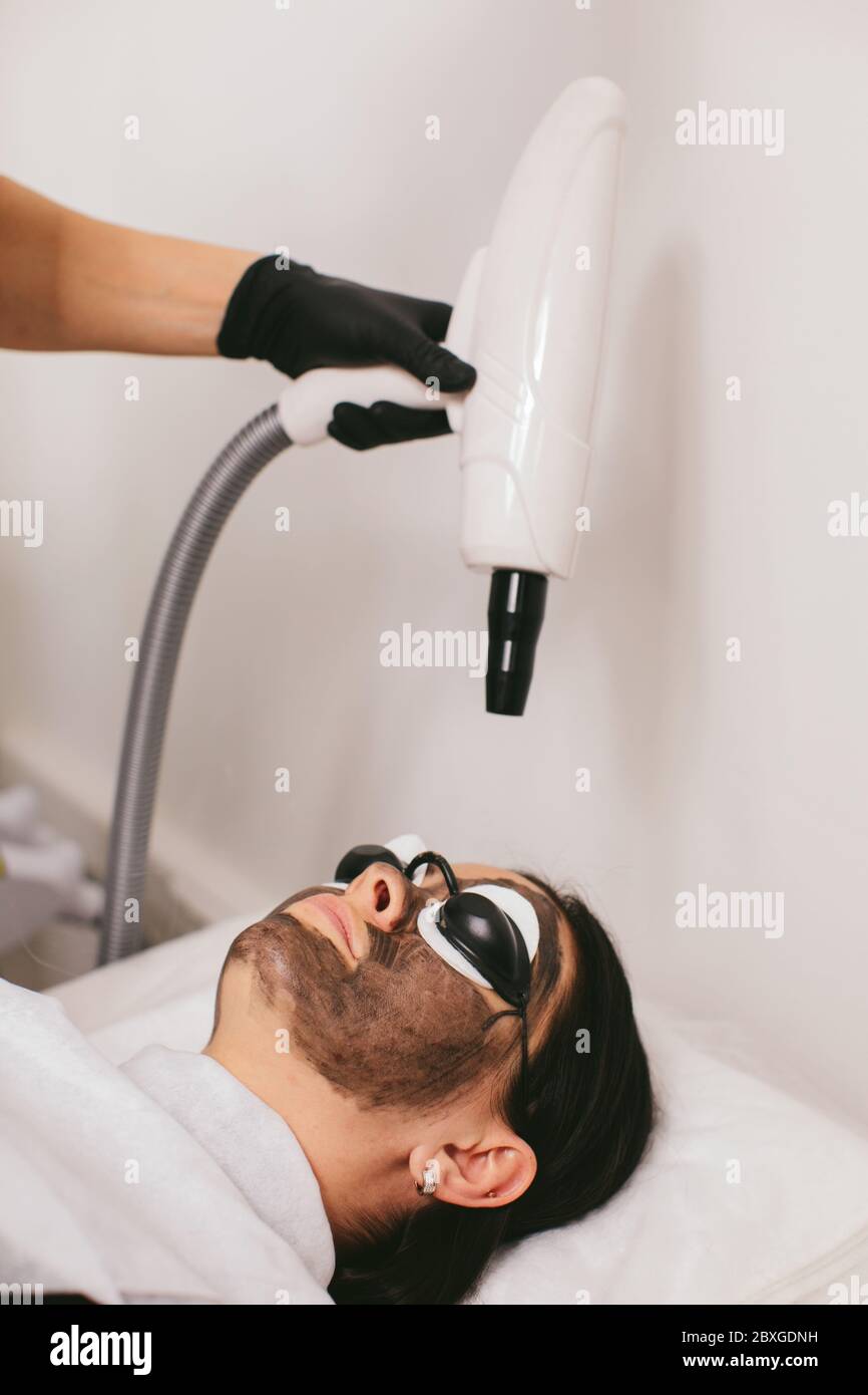 Frau mit einer Carbon Peel Schönheitsbehandlung Stockfoto