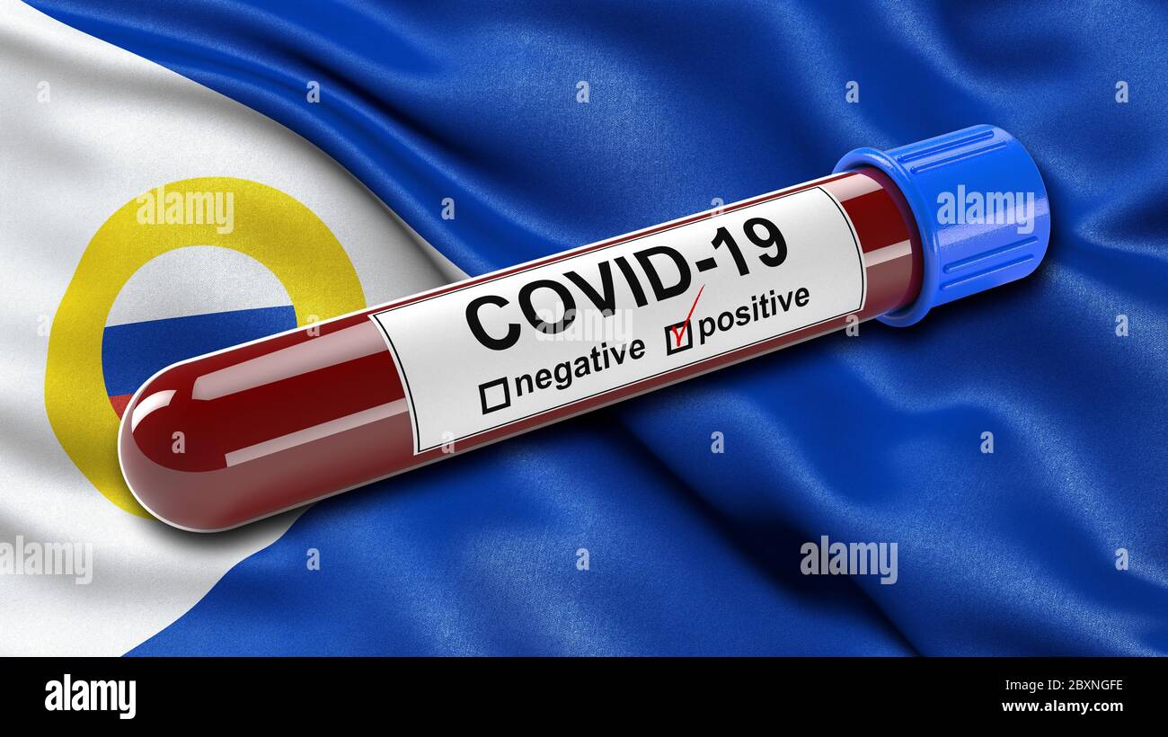 Flagge des Tschukotka Autonomous Okrug winkt im Wind mit einem positiven Covid-19 Blutprobe Rohr. 3D-Illustrationskonzept für Blutuntersuchungen zur Diagnose Stockfoto