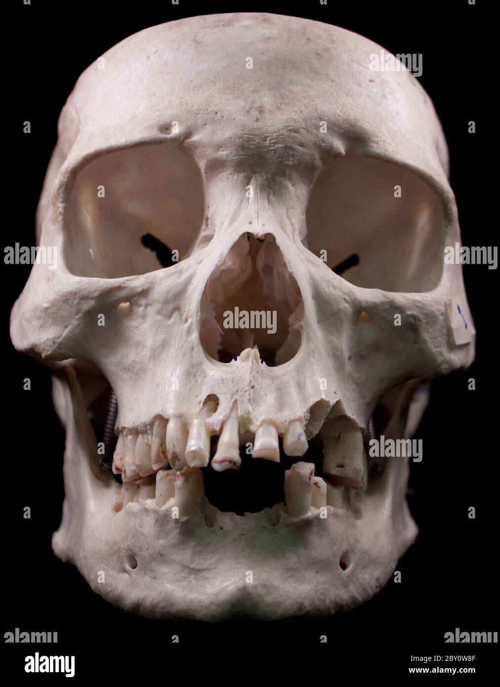 Menschlicher Schädel auf schwarzem Hintergrund Stockfoto