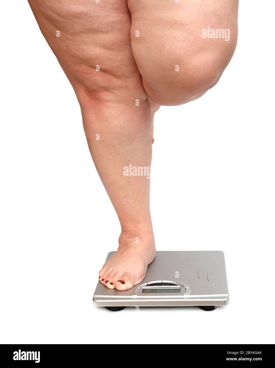 Frauen Beine mit Übergewicht Stockfoto