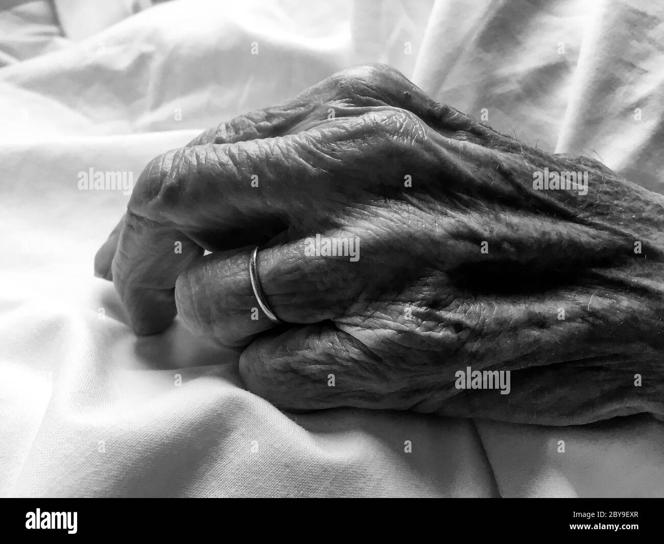 Skinny Arm Stockfotos Und Bilder Kaufen Alamy