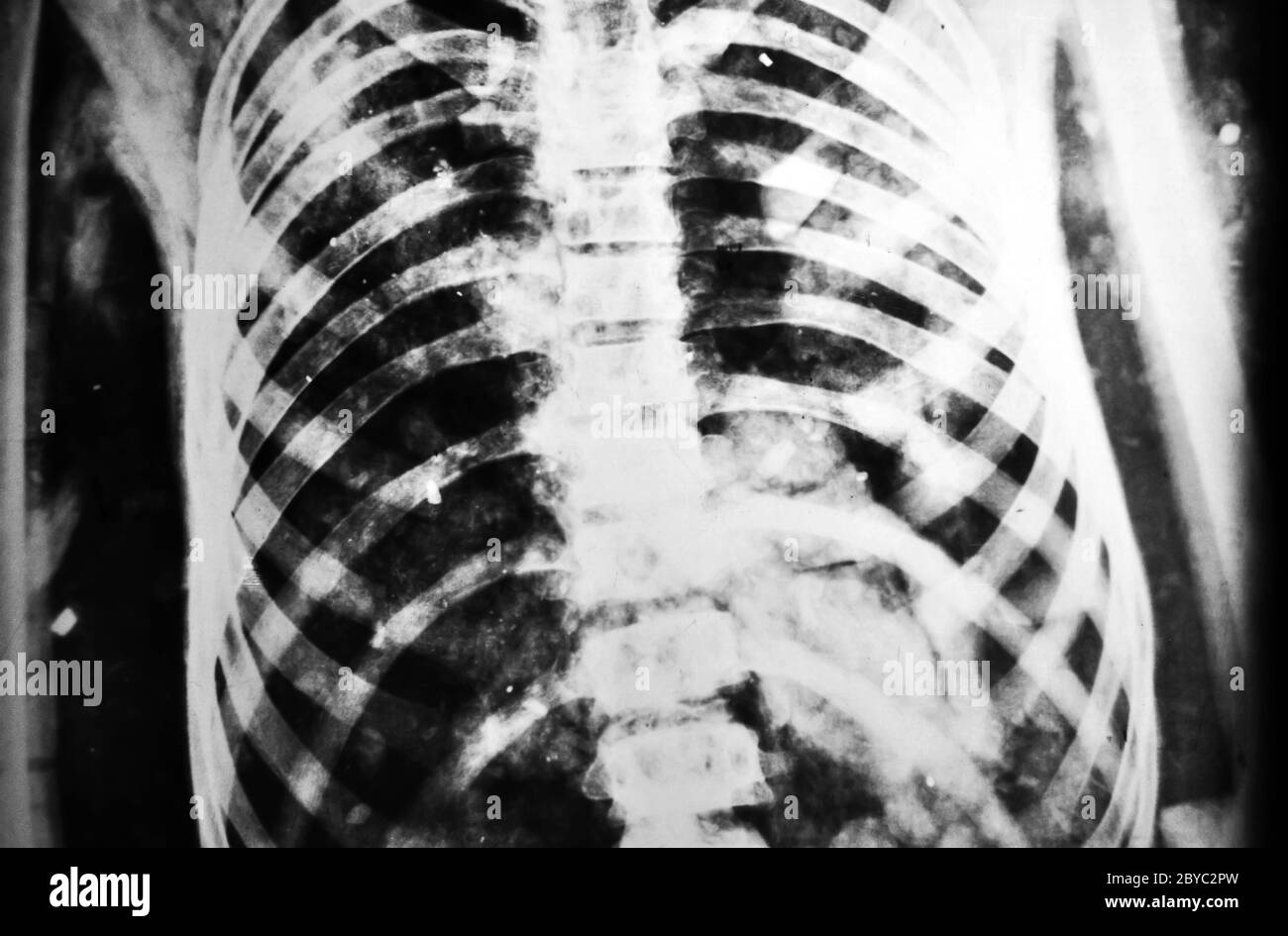 X-ray Stockfoto