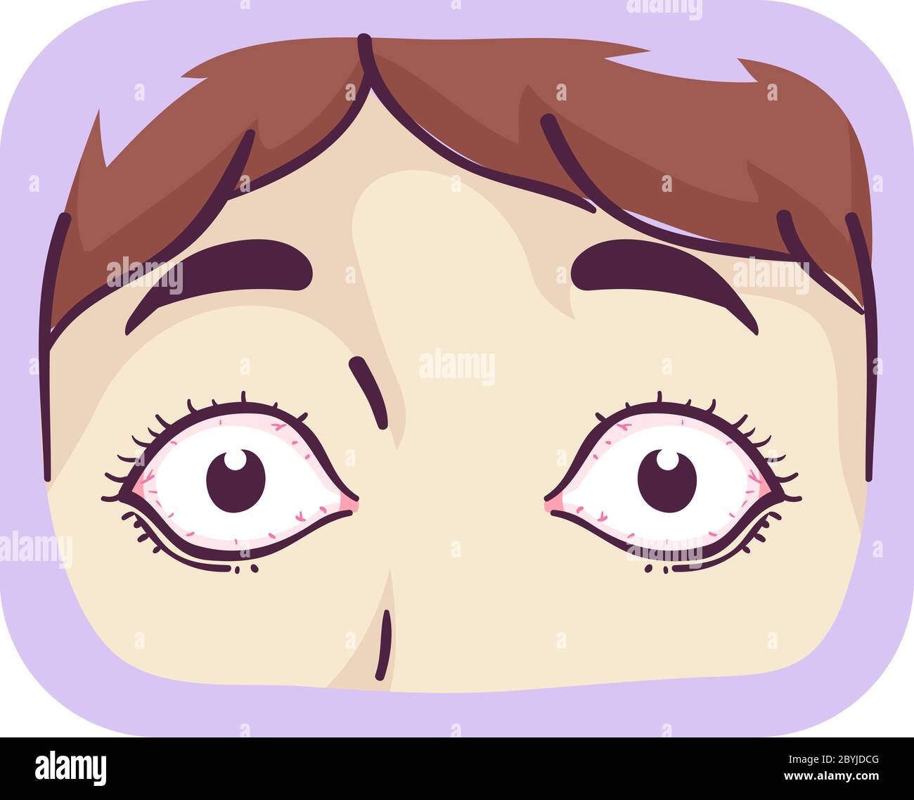 Illustration von prall Augen eines Mädchens, Symptom der Graves-Krankheit Stockfoto