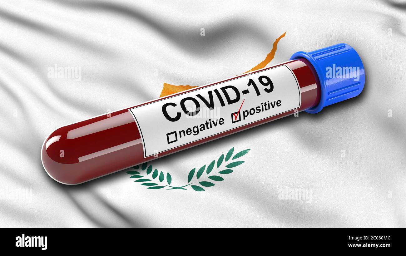 Flagge der Republik Zypern winkt im Wind mit einem positiven Covid-19 Blutteströhrchen, 3D-Illustration Konzept für Bluttests zur Diagnose der Stockfoto