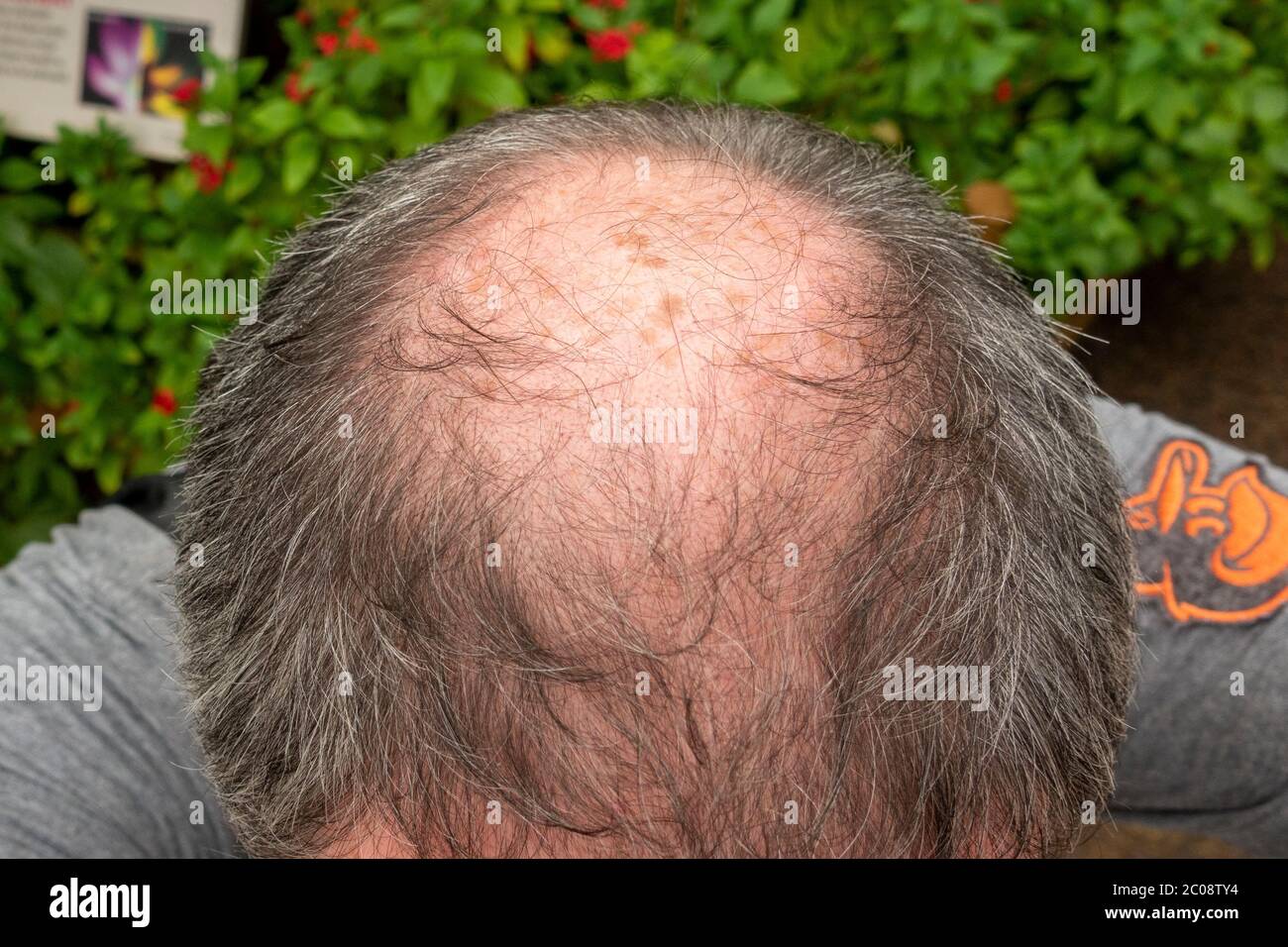 Nahaufnahme des Kopfes eines teilweise kahlen Mannes (50 Jahre alt zum Zeitpunkt des Fotos) in England. Stockfoto