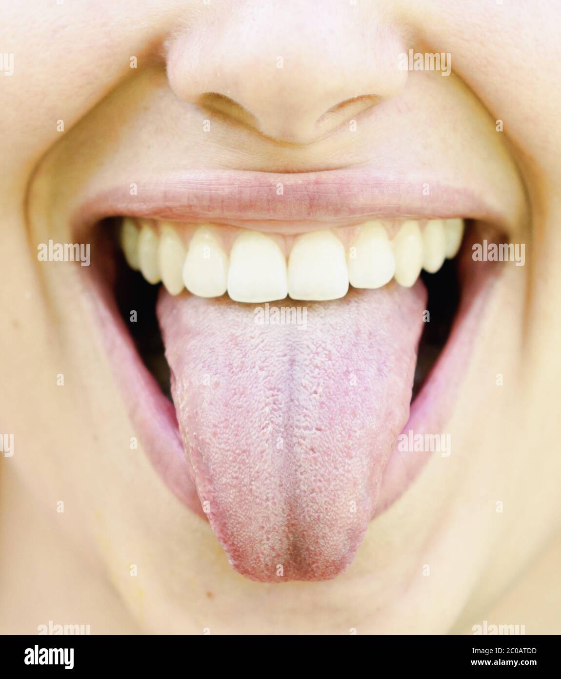 Gesunde zunge -Fotos und -Bildmaterial in hoher Auflösung – Alamy