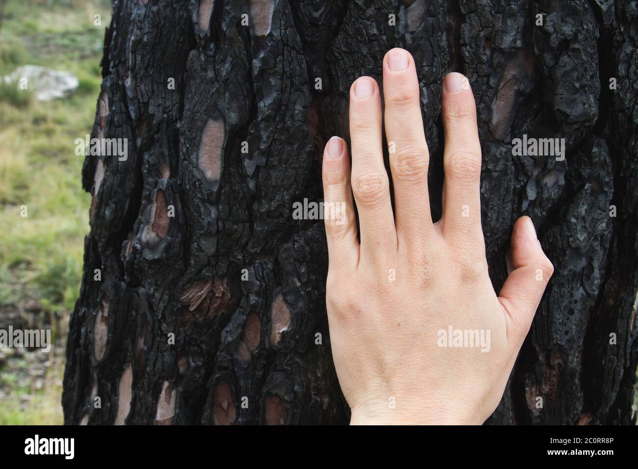 Menschliche Hand, die die Rinde eines verbrannten Baumstamms berührt Nach einem Waldbrand Stockfoto