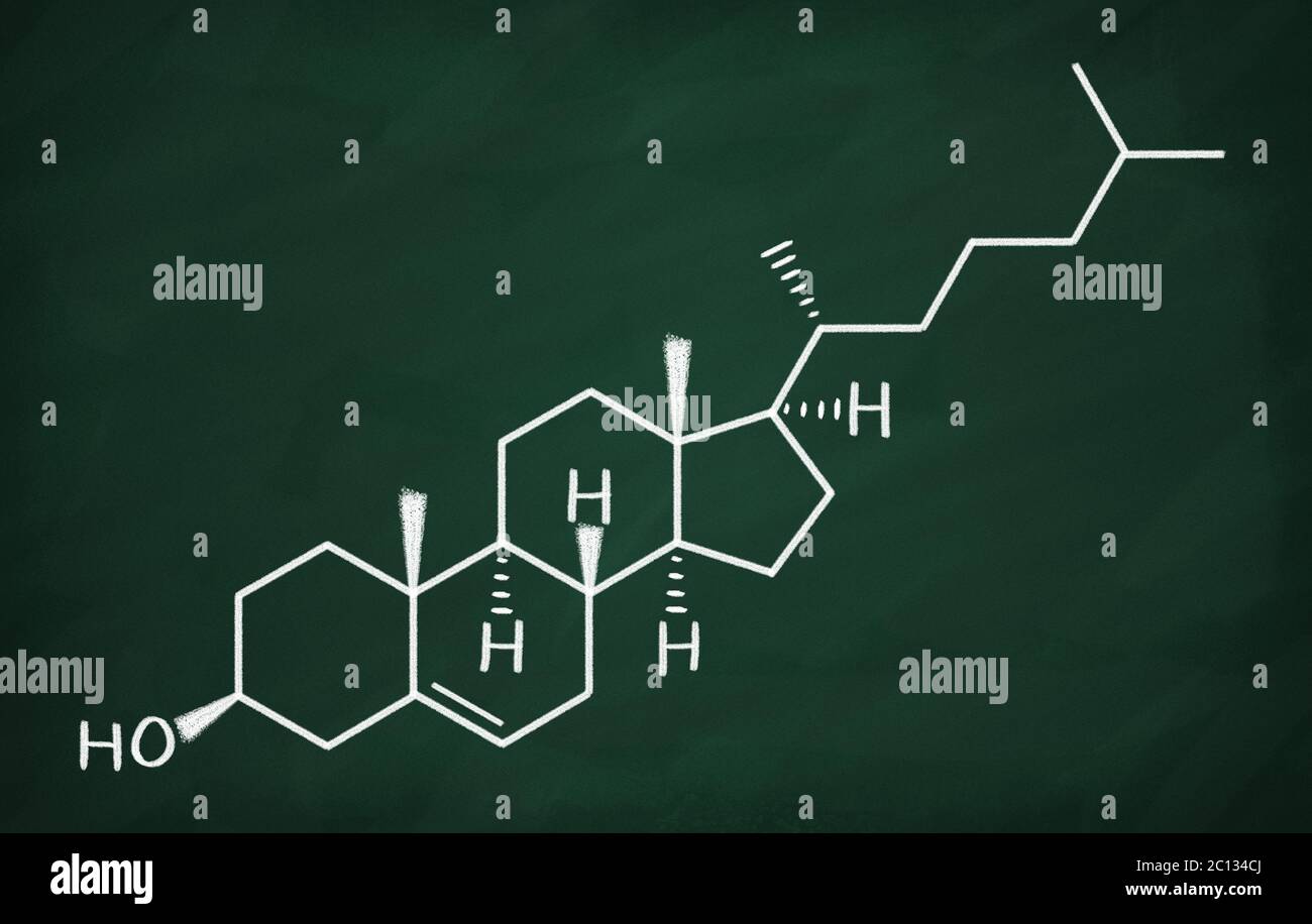 Chemische Formel des Cholesterins auf einer Tafel Stockfoto