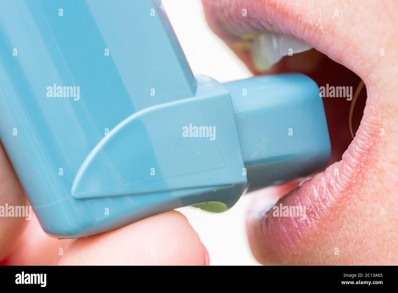Nahaufnahme einer Frau mit Asthma-Aerosol Stockfoto