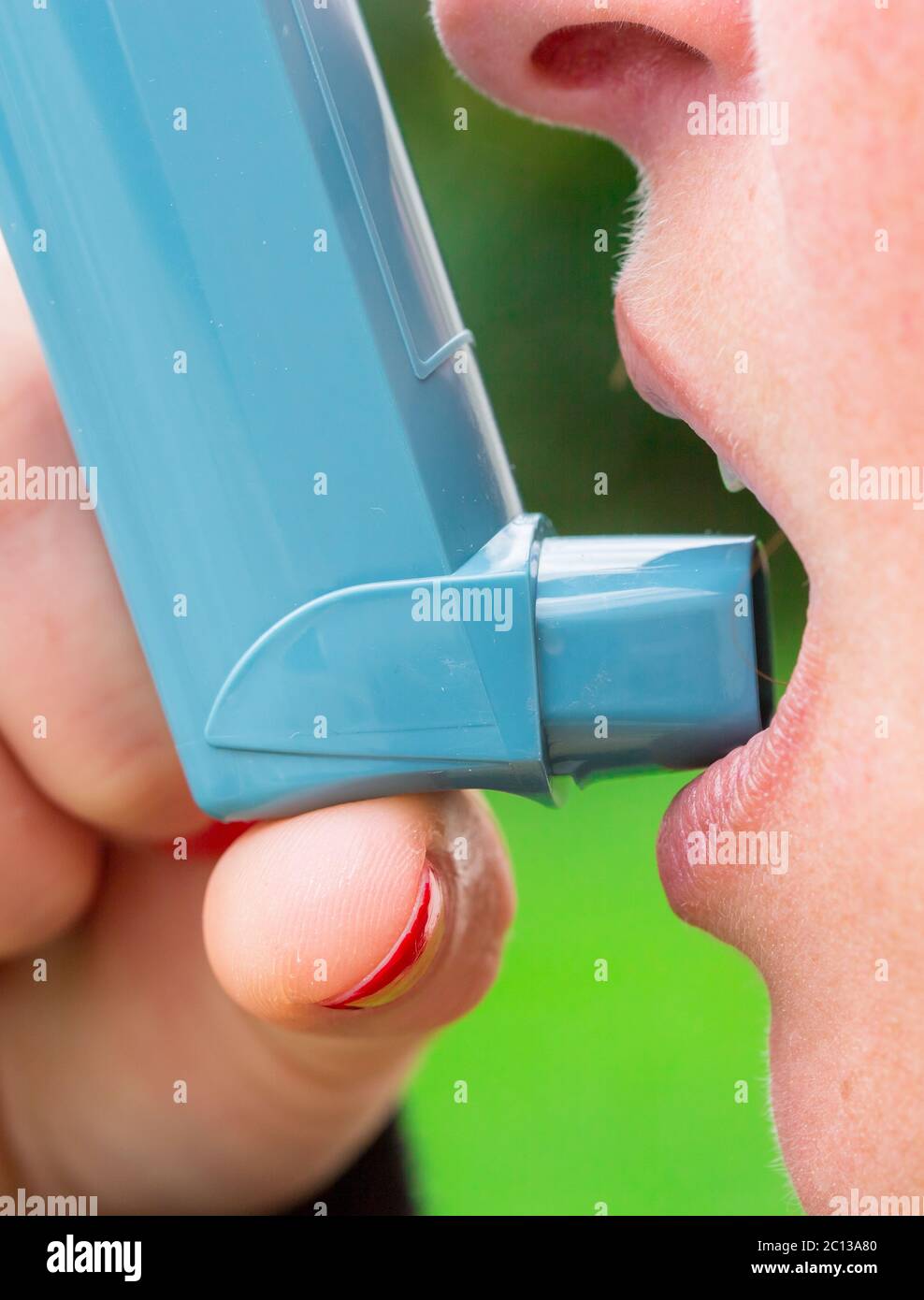Nahaufnahme einer Frau mit Asthma-Aerosol Stockfoto