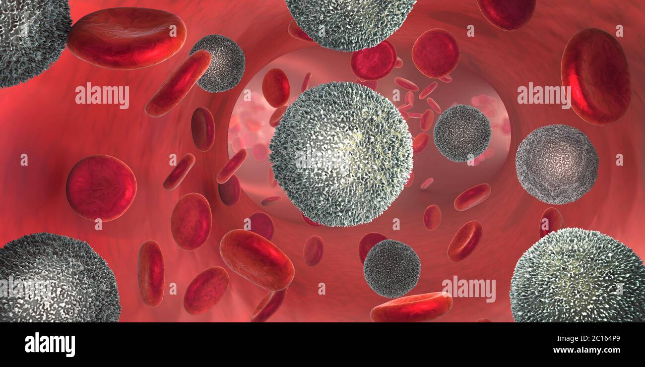 3D-Darstellung der starke Anstieg der nicht-funktionalen weißer Blutzellen, der sogenannten Leukämiezellen führt zu Blut Krebs Krankheit Stockfoto