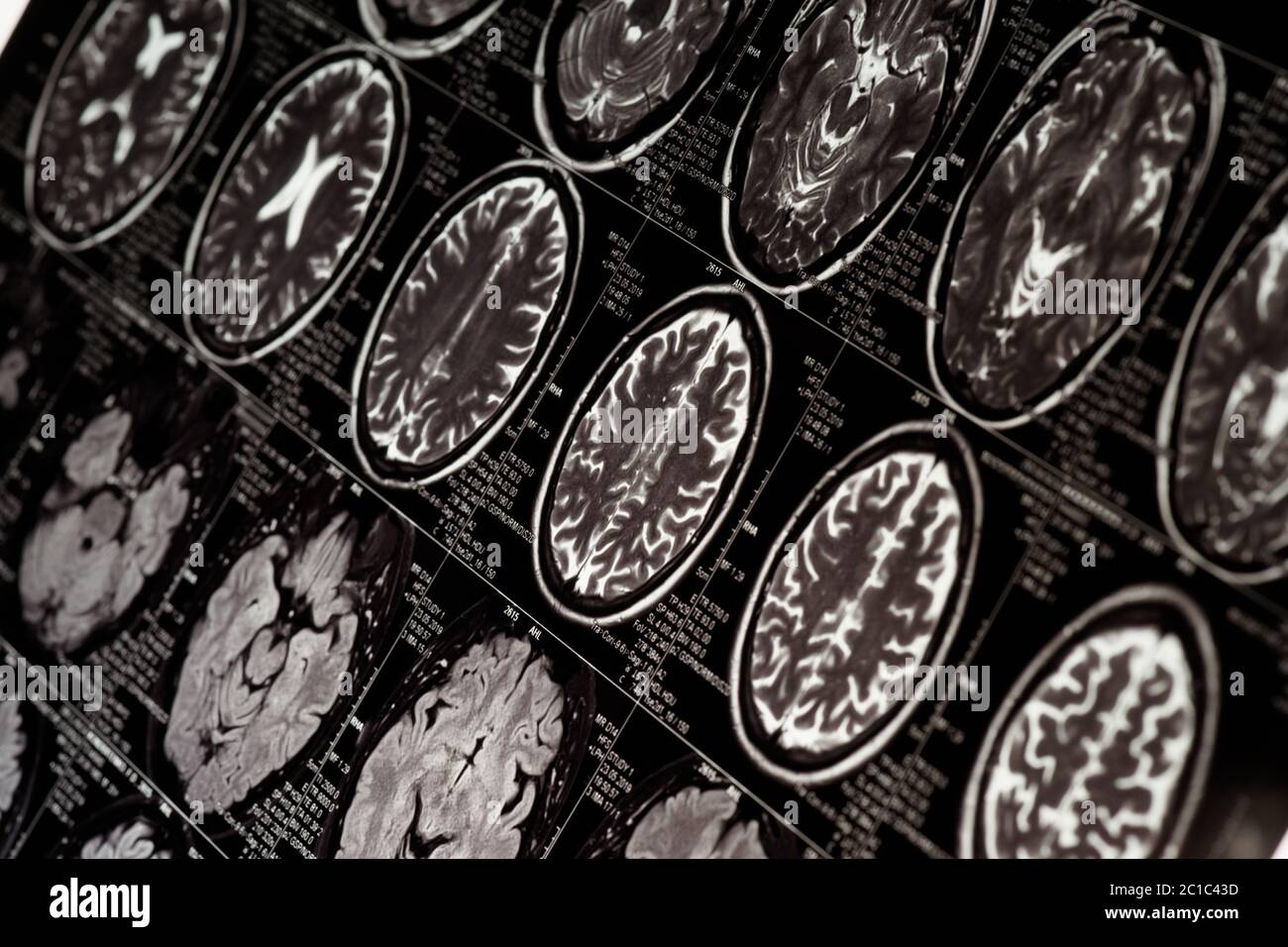 MRT-Untersuchung des menschlichen Gehirns, monochrom Stockfoto