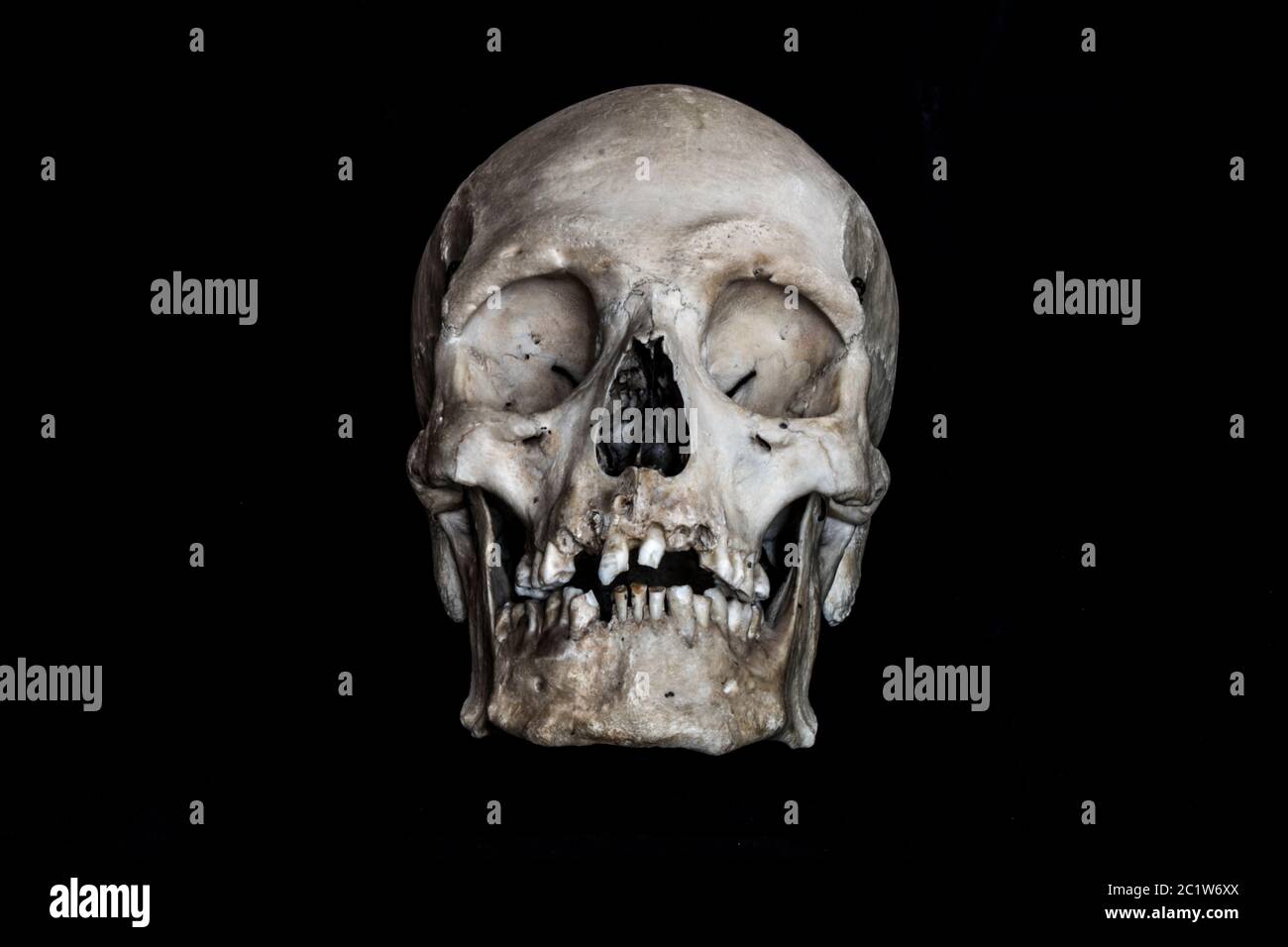 Echter menschlicher Schädel auf schwarzem Hintergrund Vorderansicht Stockfoto