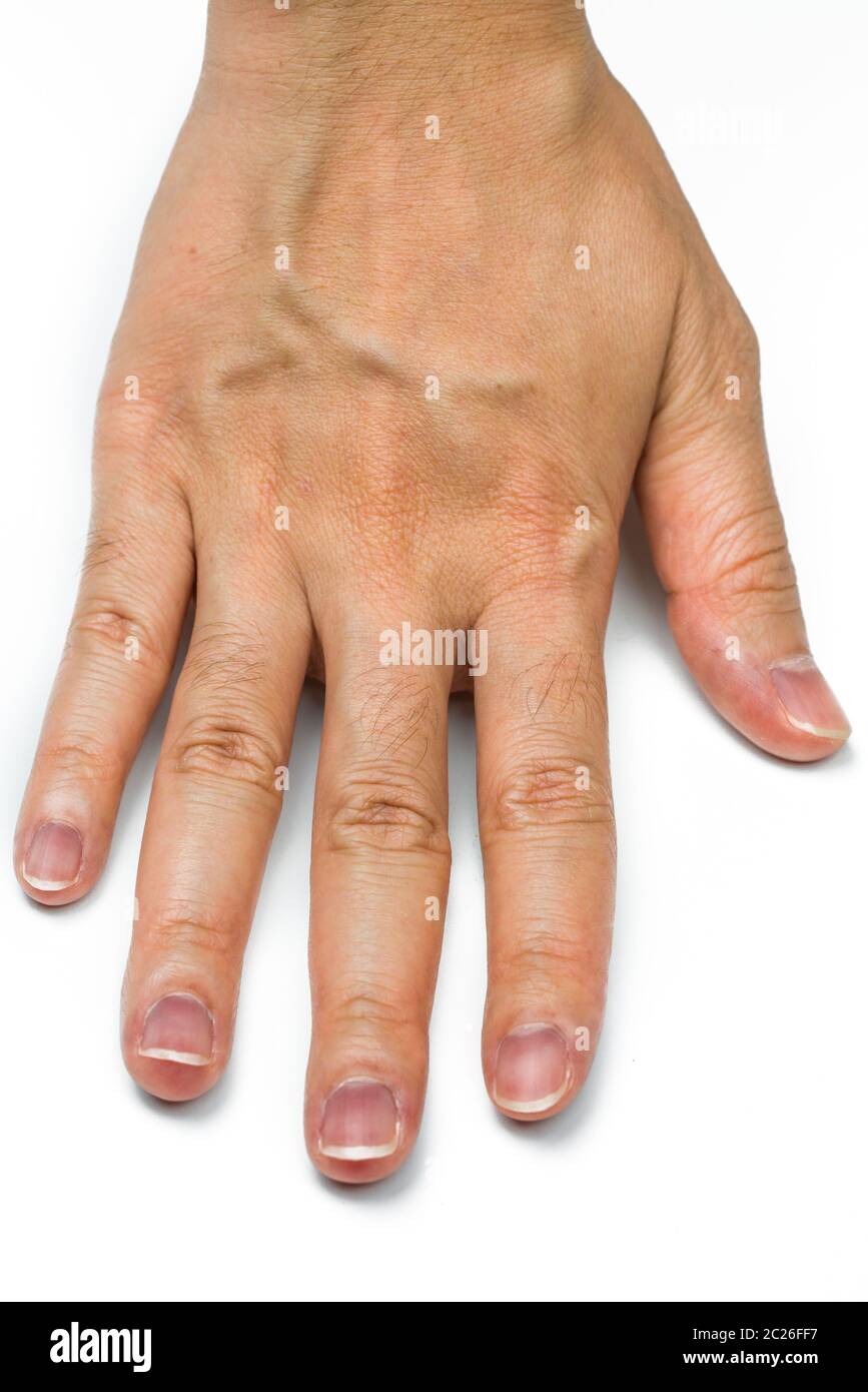 Frau Hand mit Blut Adern auf weißem Hintergrund. Finger mit Mitte - digitale Haar ist dominantes Gen. Auf dem Handrücken mit trockener Haut und Faltenbildung im adu Stockfoto