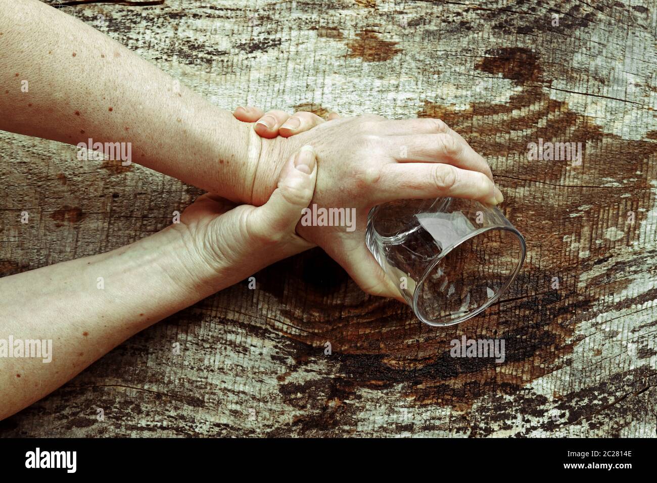 Eine Frau mit Parkinson schüttelt ihre Hände so stark, dass sie kein Glas mehr halten kann. Stark zitternde Hände einer älteren Frau Stockfoto