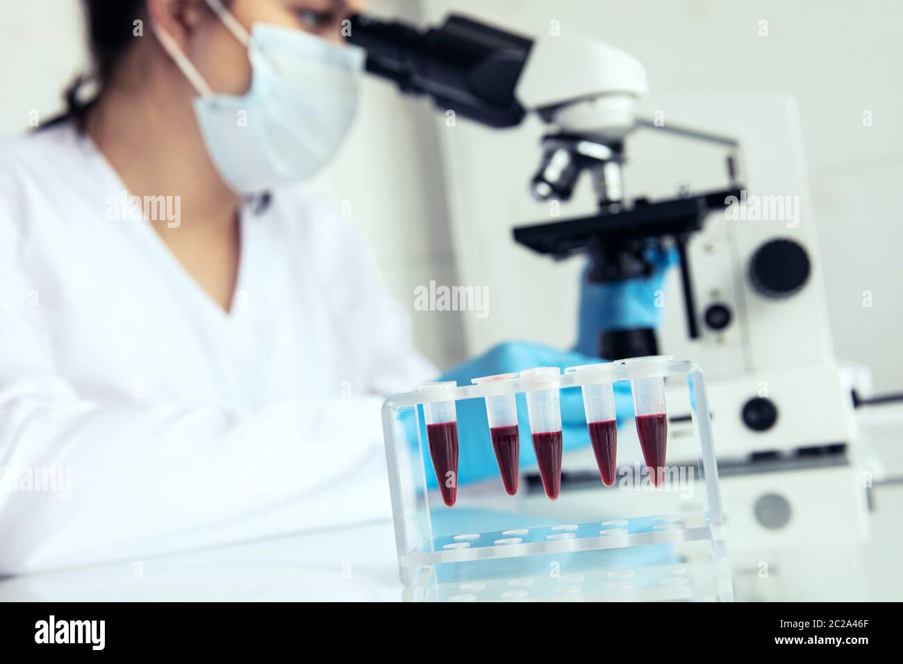 EppendorfReagenzgläser mit Blut zu untersuchen. EppendorfReagenzgläser mit Blut und